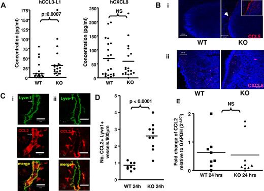 Figure 1. D6 prevents association of inflammatory chemokines with LN endothelial cells. (A) ELISA measurements of hCCL3-L1 and hCXCL8 in inguinal LNs 1 hour after injection into subcutaneously air pouches of WT and D6-deficient mice. LNs were homogenized, on ice in 200 μL PBS and cellular debris pelleted before ELISA measurement using the supernatant. NS indicates not significant. (Bi) Two representative confocal images illustrating the association of AF647-CCL5 (injected into subcutaneously air pouches) with the subcapsular sinus of inguinal LNs in D6-deficient (KO), but not WT, mice. An arrow indicates the sites of AF647-CCL5 positivity (shown as a cropped image in the inset). Original magnifications ×20 with a scan zoom at 0.7 on a Plan-Neofcuar 20×/0.5 Ph2 objective. 4,6-Diamidino-2-phenylindole (DAPI, blue) was used as a nuclear stain for cells in the LN. Scale bar represents 100 μm. (Bii) Two representative confocal images demonstrating the lack of CXCL8 accumulation in the subcapsular sinus of WT or D6-deficient (KO) LNs. Original magnifications ×40 with a scan zoom at 0.7 on a Plan-Neofcuar 60×/1.3 oil objective. Scale bar represents 50 μm. (C) Frozen skin sections were stained with anti–mouse Lyve-1 monoclonal antibody (green) and anti–mouse CCL2 polyclonal antibody (red). Representative confocal images showing a CCL2-containing dermal lymphatic in inflamed skin of (i) a D6-deficient and (ii) a WT mouse 24 hours after TPA painting. Images were acquired at 63× magnification with a scan zoom at 1.7 on a Plan Apochromat 63×/1.4 oil Ph3 objective. Scale bar represents 20 μm. (D) The frequency of CCL2+ lymphatics in the dermis of inflamed WT and D6-deficient skin per 600 μm of each section. (E) Relative CCL2 transcript levels in the skins of WT and D6-deficient mice 24 hours after TPA administration. PCR used the following primer sets: GAPDH forward, 5′-TGAACGGGAAGCTCACTGGC-3′; reverse, 5′-TCCACCACCCTGTTGCTGTAG-3′; CCL2 forward, 5′-TGAGTAGGCTGGAGAGCTACA-3′; reverse, 5′-TCACTGTC- ACACTGGTCACTC-3′. PCR was performed as described previously.21 Data are from > 3 (A-B) and 2 (C-E) independent experiments with n > 3 mice per experimental group for each individual experiment.