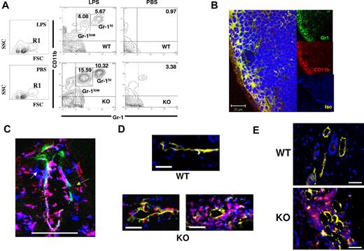 Figure 4. Perilymphatic myelomonocytic cell accumulation in D6-deficient mice. (A) Footpad injection of LPS leads to alterations in CD11b+Gr1low and CD11b+Gr1hi myelomonocytic cells in D6-deficient popliteal LNs. Representative FACS plots illustrating the R1 gate displaying the main increase in LN cell populations in LPS-treated, compared with PBS treated mice (first 2 panels). The remaining 4 panels show CD11b/Gr1 differences between WT (top) and D6-deficient (bottom) mice 24 hours after footpad injection of LPS, or control injection of PBS into the contralateral footpad. Numbers in the contour plots represent the percentage of the marked populations in each gate. Note that the 3.38% population in the D6-deficient, PBS, top right-hand quadrant, is not seen in other experiments and therefore does not represent a consistent cellular population in these mice. (B) Popliteal LNs from D6-deficient mice at 2 hours after LPS footpad injection were stained using anti–mouse Gr1 (green) and anti–mouse CD11b (red) monoclonal antibodies. In this representative confocal image, the CD11b+Gr1+ cells are denoted in yellow (merge). DAPI (blue) was used for nuclear staining. The isotype control staining is shown in the lower of the 3 insets (Iso). Note that both the anti–Gr1 and anti–CD11b antibodies are of the same isotype (rat IgG2b kappa), and so only one isotype control was needed. Images were acquired at ×63 magnification with a scan zoom at 1.0 on a Plan-Apochromat 63×/1.1 oil Ph3 objective. Scale bar represents 20 μm. (C) A dermal lymphatic vessel stained for Lyve 1 (green), CD11b (red), and Gr1 (blue). Separate CD1b+ (green arrow), Gr1+ (white arrow), and CD11b+Gr1+ (red arrow) cells are marked. Scale bar represents 50 μm. This image was cropped from a single confocal image, taken on a Zeiss LSM 510 confocal microscope. Original images were acquired at ×63 magnification with a scan zoom at 0.7 on a plan-apochromat 63×/1.4 oil Ph3 objective. (D) Perilymphatic accumulation of DCs in D6-deficient but not WT mice. DCs are labeled with CFSE/green (WT) or TAMRA/red (D6-deficient), and lymphatic vessels stained with Lyve1 (yellow). Nuclei are stained with DAPI (blue). Images were acquired using AxioVision Version 4.6, 12-2006 software on an Apotome fluorescence microscope (Zeiss AxioImager). Images were acquired at Xho magnification on an achroplan 1.0×/0.8w (water) objective. Scale bar represents 20 μm. (E) Mice were inoculated with MOG/CFA and skin examined by microscopy after 3 days. Sections from WT and D6-deficient mouse skins, at the site of inoculation, were stained for CD11c (red), Lyve-1 (yellow), and with DAPI (blue) staining for nuclei. Images were acquired using AxioVision software on an Apotome fluorescence microscope (Zeiss AxioImager). Images were acquired at Xho magnification on an achroplan 1.0×/0.8w (water) objective. Scale bar represents 50 μm. (A-B) Representative of at least 3 replicate experiments. (C-E) Representative of at least 2 replicate experiments. A minimum of 5 mice were used per experimental group for each of the experiments represented in this figure.