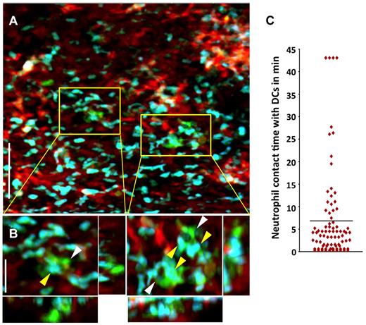 Figure 2. Neutrophils make prolonged associations with donor-derived graft-resident. (A) Intravital 2P imaging of the distribution of donor DCs (green) and recipient neutrophils (blue) within lung grafts 1 hour after B10.BR CD11c-EYFP → B6 LysM-GFP transplantation. Blood vessels appear red (nontargeted 655-nm quantum dots). Scale bar indicates 60 μm. (B) Zoomed views show several neutrophils (yellow) making contact with CD11c+ DCs (white). Scale bar indicates 15 μm. (C) Measurement of neutrophil contact time with DCs over a 43.5-minute period approximately 1 hour after engraftment. The bar represents the mean neutrophil-DC contact time of 6.8 minutes. Some cells remained associated for the entire imaging period.