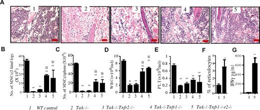 Figure 1. BMF phenotype in Tak1−/− mice is partially prevented by inactivation of TNF-α signaling. Femurs, tibias, spleens, and PB of mutant mice with indicated genotypes were collected on day 8 after induction of Tak1 gene deletion. (A) H&E-stained BM sections from indicated genotypes of mice (20 × 0.7 air). Bar represents 100 μm in length. (B-C) Numbers of MNCs from 2 hind legs (B) and spleen (C) of each mouse were counted. (D-E) WBC counts and plt (platelet) numbers in PB of mice were analyzed by CBC. (F) The percentage of reticulocytes was examined in PB by methylene blue staining. (G) Concentration of IFN-γ in PB of mice was measured by ELISA. Data are the average of 4 mice from each genotype. **Significant difference compared with WT control mice (P < .01). $$Significant increase compared with Tak1−/− mice (P < .01).