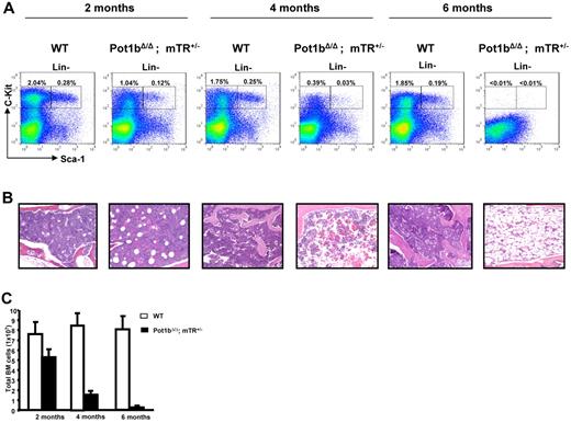 Figure 5. HSC exhaustion in Pot1bΔ/Δ;mTerc+/− mice precedes BM failure. (A) FACs analysis of multilineage negative population in aging Pot1bΔ/Δ; mTerc+/− mice. Numbers are the percentage of LSK and LK cells in total BM. Each age group represents a minimum of 4 mice. Lin−: muiltilineage negative. (B) BM morphology in the diaphysis of the bone of wild-type and Pot1bΔ/Δ; mTerc+/− mice at the indicated ages (×20 magnification). Each image corresponds to the above flow cytometric analysis. (C) Quantification of total BM nucleated cell counts for wild-type (WT) and Pot1bΔ/Δ; mTerc+/− mice at the indicated ages. Each age group represents a minimum of 4 mice. Error bars represent SEM.