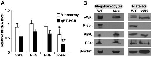 Figure 1. mRNA and protein expression level of α-granule contents in WT and ki/ki mice. (A) Relative expression levels of mRNA for VWF, PF4, PBP, and P-selectin (P-sel) from FL-derived megakaryocyte total RNA isolated from WT and sibling FOG1 ki/ki mice. Open bars represent data from microarray analysis; and closed bars, quantitative RT-PCR analyses of similar samples. Data are mean ± SD. For microarray, N = 3; for quantitative RT-PCR, N = 7, each measured in duplicate. *P < .05, for microarray dataset. **P < .01, for quantitative RT-PCR dataset. (B) Representative Western blot analysis for α-granule proteins in both FL-derived megakaryocytes and isolated platelets from FOG1 ki/ki mice and sibling WT mice. β-actin was probed as a loading control.