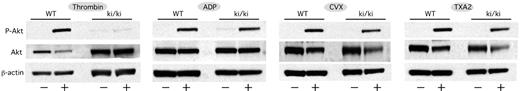 Figure 6. Impaired Akt phosphorylation in response to thrombin stimulation in FOG1 ki/ki platelets. WT or FOG1 ki/ki platelets were stimulated for 10 minutes with thrombin (1 U/mL), ADP (10μM), convulxin (CVX; 6nM), or the thromboxane A2 analog U46619 (TXA2; 10μM), and then cell lysates were analyzed by Western blot analysis for Akt phosphorylated at Ser473 (P-Akt), total Akt, or β-actin as a control. Shown is a representative Western blot analyzing an equal number of WT and FOG1 ki/ki platelets from littermate mice before or after stimulation by the indicated agonists.
