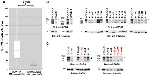 Figure 3. BCOR mRNA and protein expression in AML patients carrying BCOR disruptive mutations. (A) Box plots of BCOR mRNA levels quantified by real-time RT-PCR in 5 primary AML patients with BCOR disruptive mutations introducing premature stop codons (before the second last exon) compared with 14 BCOR-unmutated AML patients. All of the 5 BCOR-mutated AML patients display substantially decreased BCOR mRNA levels (P = .006 by Wilcoxon 2-sample test of ΔCt values). (B) Western blot analysis of BCOR protein expression in normal donor CD34+ hematopoietic cells (CD34+ I and CD34+ II, left panels) and in primary AML cells isolated from 15 patients with wild-type BCOR gene (right panels) showing a specific protein band of variable intensity corresponding to full-length BCOR (192 kDa predicted MW; arrow). (C) Western blot analysis of primary AML cells isolated from 5 patients harboring BCOR disruptive mutations (labeled in red: patient 326 with Thr733AlafsX5; patient 406II with Asn1485LysfsX5; patient 258A with Leu245ThrfsX19; patient 447A with Pro1115ThrfsX41; and patient 644A with His674MetfsX41). As a comparison, full-length BCOR expression in lysates from further 4 AML patients (patients 226, 157, 309, and 409) all devoid of BCOR mutations is shown. In the top panels, a specific protein band corresponding to full-length BCOR (192 kDa predicted MW) is observed (arrow) in wild-type BCOR AML, but not in BCOR-mutated AML. In patient 406II, a new faint band is detected (arrowhead) that likely corresponds to a truncated BCOR protein (162 kDa predicted MW). (B-C) The OCI/AML3 cell line not carrying BCOR mutations was used as a positive control for full-length BCOR protein expression. Protein lysate loading was evaluated by blotting the membranes with an anti-NPM1 or anti–β-tubulin Ab. Vertical lines have been inserted to indicate repositioned gel lanes.