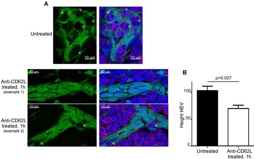 Figure 3. Blockade of lymphocyte homing to LN induces the disappearance of HEV pockets. (A) Confocal images of LNs section from a RAG-2°/°ubiquitin-GFP chimera (green) injected or not intravenously for 1 hour with 100 μg of anti-CD62L blocking Ab (MEL-14) and stained for CD3 (red) and sytox 63/nuclei (blue). Arrowheads point to HEV pockets. (B) Height (and standard error) in arbitrary units of LN HEV (see “Morphoretic analysis of HEV”). Data are representative of 2 different experiments (2 mice per experiment, ∼ 15 analyzed HEVs for each condition per experiment).