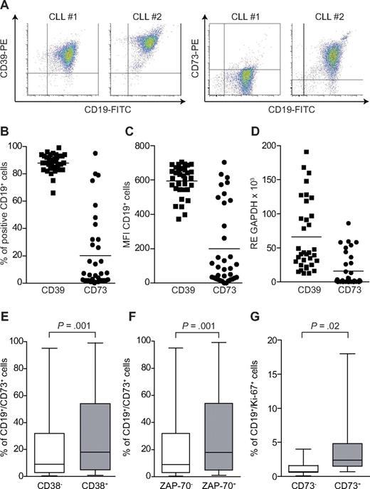 Figure 3. Expression of CD39 and CD73 in a cohort of CLL patients. PBMCs purified from CLL patients were stained with anti–CD19-FITC and anti–CD39-PE or anti–CD73-PE. (A) Representative density plots from 2 different samples. Cumulative data on the percentage of double-positive cells or the MFI are reported in panels B and C, respectively. n = 35. (D) RT-PCR data on the mRNA levels of CD39 and CD73 in the same cohort of patients. n = 35. Mean values of expression are represented as a horizontal line. (E-F) Correlation between the expression of CD73 and CD38 (n = 299) and CD73 and ZAP-70 (n = 295), adopting the arbitrary cut-off value of 20%. (G) Percentage of CD19+/Ki-67+ cells in a subset of patients characterized by low (< 10%) and high (> 70%) CD73 expression. Data in panels E to G are expressed as box plot, where the top and the bottom of the box represent the first and the third quartiles, respectively; the horizontal line within the box indicates the median; and the whiskers represent the mean ± SEM. Statistical analysis was performed using Student t and Mann-Whitney U tests.