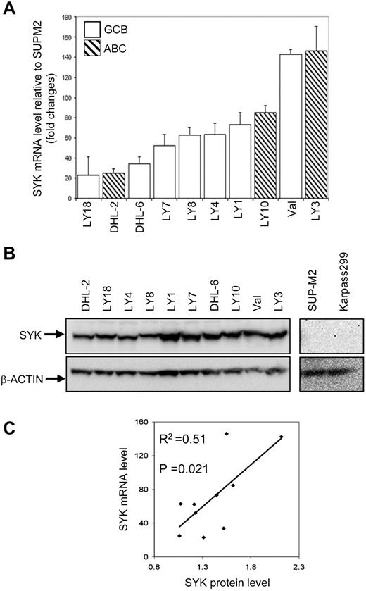 Figure 1. SYK is expressed in a panel of DLBCL cell lines. (A) Expression of SYK mRNA in a panel of 10 GCB-type or ABC-type DLBCL cell lines by real-time PCR. PKG1 was used as the internal control gene for normalization. Results were expressed as relative expression to SUP-M2, a T-cell lymphoma cell line that does not express a significant amount of SYK. Error bars show means ± SD from 3 independent experiments with duplicate reactions. (B) Expression of SYK protein in the cell lines by immunoblotting. β-actin was included as a loading control. (C) Correlation between SYK mRNA and protein levels was analyzed by linear regression. The level of significance was set at P = .05.