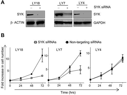 Figure 4. Growth of sensitive DLBCL cells is inhibited by siRNA against SYK. (A) Immunoblots of SYK protein in LY18, LY7, and LY4 cells that were transfected with a scrambled (-) or a SYK-specific (+) siRNA pool. β-actin or GAPDH was blotted as a loading control. (B) Simultaneous cell counting was conducted at the indicated times after transfection. The -fold increase in cell number indicates viable cell number relative to those at time 0.