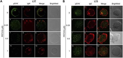 Figure 6. Effects of PRT318 on SYK phosphorylation in sensitive and resistant DLBCL cells. (A) Confocal images of sensitive LY7 cells treated with or without various concentrations of PRT318 as indicated on the left of the images. Proteins labeled are indicated at the top of the images. Merged and bright-field images are also shown. (B) Confocal images of resistant LY3 cells treated with or without various concentrations of PRT318, as indicated on the left of the images. Molecules labeled are indicated on top of the images. Merged and bright-field images are also shown.