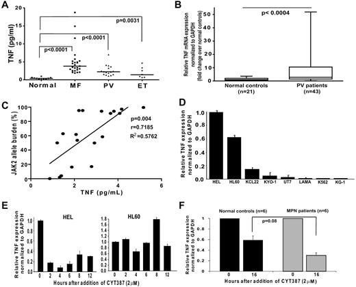 Figure 1. TNFα mRNA correlates with JAK2 kinase activity. (A) TNFα plasma concentration was evaluated in 48 MPN patients (16 PV, 7 ET, 25 MF) and 10 normal controls. Each data point represents a patient. Median TNFα concentration is shown as a bar. Detailed patient information including JAK2V617F status is provided in supplemental Table 1 (available on the Blood Web site, see the Supplemental Materials link at the online article). (B) qRT-PCR analysis of median TNFα mRNA expression of Peripheral blood leukocytes from 43 PV patients and 21 normal controls. Median TNFα expression in cells from normal controls was normalized to 1. (C) Correlation between JAK2V617F allele burden and TNF plasma concentration. Allele burden was determined in 20 JAK2V617F-positive patients by real-time quanitative PCR and correlated with TNF plasma concentration. (D) TNFα mRNA expression was analyzed by qRT-PCR in human hematopoietic cell lines and normalized to GAPDH. The TNFα expression in HEL cells was arbitrarily set to 1 and results for the other lines are shown in comparison. (E-F) TNFα mRNA expression after pharmacologic inhibition of JAK2, (E) HEL (left) and HL60 (right) cells treated with JAK2 inhibitor CYT387, (F) primary human blood MNCs treated with CYT387.