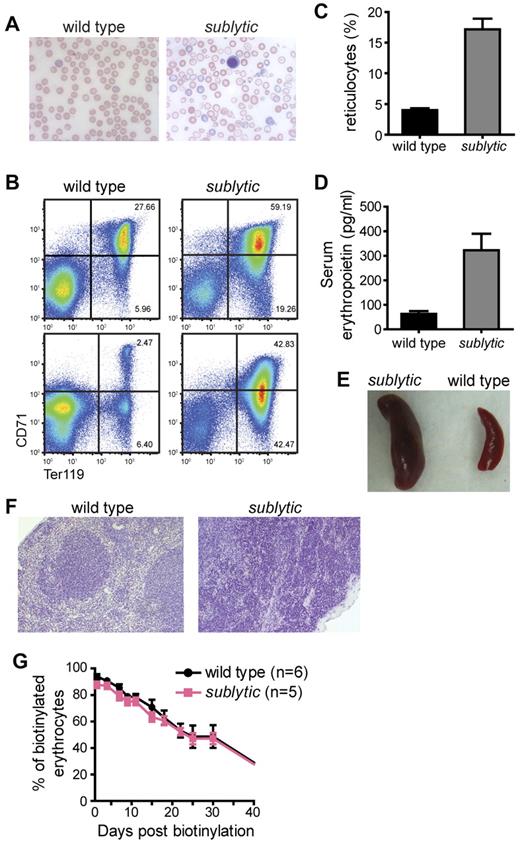 Figure 1. Sublytic mice develop severe anemia. (A) Morphology of RBCs from a wild-type and sublytic mouse. RBCs were examined after Wright-Giemsa staining, and photographed at a 63× magnification (oil) under light microscopy. (B) BM cells (top panels) and splenocytes (bottom panels) prepared from wild-type and sublytic mice were labeled with Ter119 and CD71 Abs and analyzed by flow cytometry. Values indicate the percentage of cells in each quadrant. (C) Reticulocytes were stained with thiazole orange and counted by flow cytometry. The percentage of reticulocytes in the blood is shown (n = 6 for both wild-type and sublytic mice). (D) Serum erythropoietin was measured by ELISA (n = 3 for both wild-type and sublytic mice). Data represent means ± SEM. (E) Whole spleens from a sublytic homozygous and a wild-type mouse at approximately 9 months of age. (F) Sections of spleens from wild-type and sublytic mice stained with H&E are shown at a 20× magnification. (G) In vivo RBC survival. RBCs were labeled with biotin in vivo by injecting mice with N-hydroxysuccinimide-biotin at 6 weeks of age. The survival of RBCs was followed by measuring the percentage of labeled erythrocytes by flow cytometry.