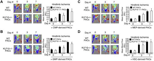 Figure 5. Effect of KLF10−/−PACs on blood flow recovery in WT mice. (A-D) WT mice underwent femoral artery ligation to induce hindlimb ischemia. WT or KLF10−/− CMP-, GMP-, MEP-, or HSC-derived PACs were intramuscularly injected immediately after femoral artery ligation (n = 5 per group). Mean blood flow recovery (ischemic leg/nonischemic leg) was measured by tissue Doppler imaging. *P < .05 versus WT PACs.