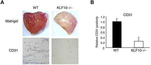 Figure 6. Reduced angiogenesis in Matrigel plugs implanted in KLF10−/− mice. (A-B) Matrigel plugs subcutaneously implanted for 8 days in WT or KLF10−/− mice (n = 10 per group) were stained for CD31. (A) Angiogenesis in whole Matrigel plugs. Matrigel images were photographed with an Olympus, Model SZ61 camera (top). CD31 staining in paraffin sections (5 μm; bottom) was analyzed with an Olympus, Fluoview, Model FV1000 camera at 10× magnification and FV10-ASW Version 02.01 software and quantitated as relative CD31 positivity (B). *P < .01 versus WT.