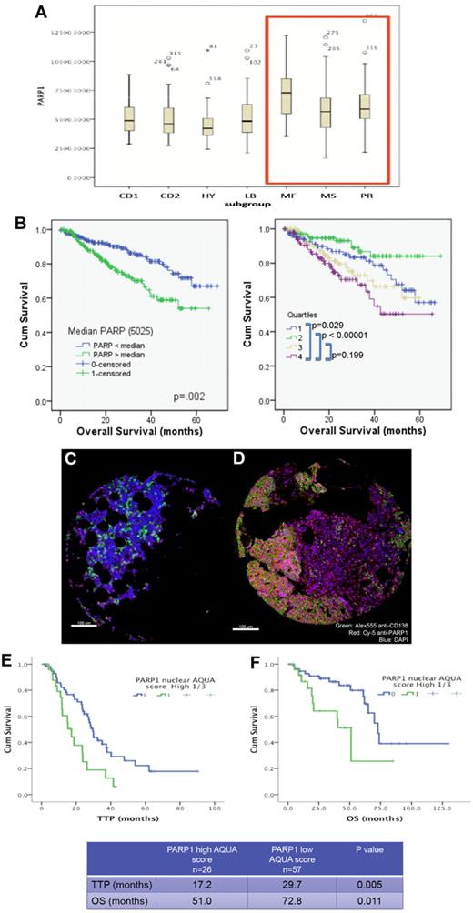Figure 1. High PARP1 expression is correlated with poor survival in MM. (A) Box plot displaying PARP1 mRNA range of expression (Affymetrix probe 208644_at) according to the molecular subgroup in a cohort of MM patients from the Arkansas dataset (GSE4581). Note the higher PARP1 expression in the MR, MS, and PR subgroups. (B) Kaplan-Meier overall survival curves of MM patients treated in total therapy 1 and 3 according to PARP1 mRNA expression above or below the median value of 5025 (left panel) or according to the quartiles distribution (right panel) of PARP1 mRNA expression based on National Institutes of Health GEO dataset deposited by Dr J. D. Shaughnessy Jr under accession number GSE4581. Quartile 4 represents the subgroup with the highest PARP1 expression. The 60-month OS for patients with PARP1 below and above the median are 67% and 54%, respectively (P = .02). (C-D) Myeloma tissue microarray constructed from the BM biopsies of 83 newly diagnosed MM patients was used to evaluate the expression of PARP1 by immunofluorescence staining and its impact on prognosis. Shown are representative histospots with low and high AQUA score for PARP1 expression, respectively, in panels C and D. AQUA scores are calculated based on the average PARP1 signal intensity per compartment area (CD138+ cells) of 3 representative histospots per patient (detailed methodology for AQUA score calculation is provided in supplemental Methods). Staining for DAPI, CD138, and PARP1 is merged together in the figure. (E) Kaplan-Meier survival curves indicate the shorter time to progression (TTP) and overall survival (OS) for patients with MM cells expressing high protein levels of PARP1.