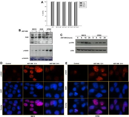 Figure 2. Effects of ABT-888 on MM-cell survival, PARP1/2 activity, and DNA damage. (A) Effect of ABT-888 on MM-cell survival. Cells were treated with 0-20μM ABT-888 for 72 hours and viability was determined by annexin V/PI staining. Results shown here are representative of 3 independent experiments. (B-C) Protein levels of PAR polymers and γ-H2AX (p-Ser139-H2AX) (B) and p-ATM and ATM (C) after ABT-888 treatment in MM cell lines. Representative blot of PAR, γ-H2AX, p-ATM, and ATM both before and after 5μM ABT treatment is shown. (D-E) Effects of ABT-888 on γ-H2AX foci formation induced by ABT-888 (5μM) over time in OPM2 and MM1S MM cells and detected by immunofluorescent microscopy. Image acquisition was performed with an epifluorescence microscope (BX51; Olympus) and multispectral color camera (Nuance FX; CRi) with a 60× magnification lens and oil immersion.