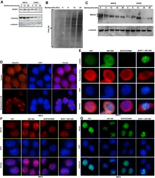 Figure 4. Effects of bortezomib on ubiquitin cellular distribution and HR molecules at the posttranscriptional level. (A) Immunoblot analysis for FANCD2 and RAD51 protein expression in MM cell lines treated with 2.5nM bortezomib for 12 and 24 hours. (B-C) Protein extracts from MM1S and OPM2 cells treated for the indicated times with 2.5nM bortezomib were subjected to Western blot analysis. As shown, treatment with bortezomib results in the accumulation of polyubiquitin (B) and decreases the ubiquitylation of BRCA1 (C). (D-G) Immunofluorescent microscopy was used to analyze free ubiquitin and polyubiquitin cellular distribution and to detect γ-H2AX, BRCA1, and RAD 51 foci formation induced by bortezomib and/or ABT-888 treatment in OPM2 and MM1S (images for OPM2 cells are included in the supplemental materials). Cells were co-treated with bortezomib (2.5nM) and/or ABT-888 (5μM) for 24 hours. Shown in panel D are the effects of bortezomib on ubiquitin cellular distribution in MM with rapid depletion of the nuclear ubiquitin pool in bortezomib-treated cells. Cy5-labeled Ab was used to detect free ubiquitin and DAPI was selected for nuclear staining. (E) Effects of ABT-888 and/or bortezomib on γH2AX foci formation and polyubiquitin (FK2). Bortezomib did not affect ABT-888 γH2AX foci formation, but did inhibit the polyubiquitylation of γH2AX. (F-G) Effects of ABT-888 and/or bortezomib on BRCA1 (H) and RAD51 (G) foci formation. BRCA1 and RAD1 foci induced by ABT-888 were completely resolved in cells cotreated with bortezomib. Image acquisition was performed with an epifluorescence microscope (BX51; Olympus) and multispectral color camera (Nuance FX; CRi) with a 60× or 100× magnification lens and oil immersion.