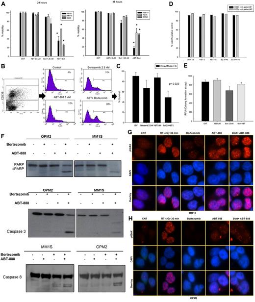 Figure 6. In vitro effects of ABT-888 and bortezomib in MM cells. (A) Cells were cultured in control medium or in the presence of ABT-888 (2.5μM) and/or bortezomib (1.25nM) for 24-48 hours. Viability was determined by annexin V/PI staining. Results shown are means ± SD of 3 independent sets of experiments. *P < .05. (B) Effects of ABT-888 and bortezomib on CD138+ primary myeloma cells. BM mononuclear cells isolated by Ficoll gradient from the BM aspirate of MM patients and then cultured in 20% medium with or without ABT-888 (5μM) and/or bortezomib (2.5nM) for 24 hours. MM cells were identified by CD138 staining and flow cytometric analysis. Viability of CD138+ cells was determined by annexin V/PI staining. A representative experiment is shown here. (C) Effects of the combination of ABT-888 and bortezomib in 8 different MM patients. Viability was determined by annexin V/PI staining. (D) Effects of ABT-888 and bortezomib on CD34+ peripheral blood stem cells. Cells were cultured in 20% medium with or without ABT-888 (5-10μM) and/or bortezomib (2.5nM) for 24 hours. Viability was determined by annexin V/PI staining. Two representative samples are shown here. (E) Effects of the combination of ABT-888 and bortezomib on CD34+ peripheral blood stem cell function using a GM-CFU assay (CytoSelect; Cell Biolabs). At 10 days, colonies were quantified using a fluorescence plate reader (485/520 nm filter set) according to the assay protocol. (F) Cleavage of PARP, caspase 3, and caspase 8 was examined after exposure of MM cells to bortezomib (2.5nM) with or without ABT-888 (5μM) for 16 hours. (G-H) Effects of ABT-888 and bortezomib on γ-H2AX foci formation in MM cells treated with ABT-888 (5μM) and bortezomib (2.5nM) for 24 hours. Treatment with radiation (4 Gy for 30 minutes) was used as positive control for γ-H2AX foci formation in response to DNA damage.