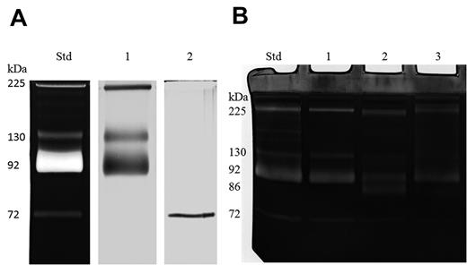 Figure 1. Gelatin zymograms of cord blood and mature platelets from healthy individuals. Human platelets from peripheral blood and cord blood samples were obtained from the Blood Transfusion Center and the Gynecology Unit of the Hospital of Urbino. Umbilical cord blood samples were collected immediately after delivery from women with uncomplicated healthy pregnancies; peripheral blood samples were drawn from healthy volunteers. Washed platelets were freshly isolated according to CD45+ leukocytes depletion and lysis procedure detailed in Cecchetti et al1 (40mM Tris-HCl, 0.3M NaCl, 1mM EDTA, 1mM Na3VO4, 1mM NaF, NaN3 0.05%, NP-40 1%, pH 7.4). After centrifugation (20 000g, 4°C for 20 minutes) to remove cellular debris, the supernates of MMP standards from whole cord blood and the cleared platelet lysates were analyzed through Western blotting (using monoclonal antibody against MMP-2 and MMP-9) and gelatin zymography.5,10 Sample aliquots (containing 250 μg of total protein) were analyzed on 7.5% polyacrylamide gels containing 2 g/L gelatin 90 Bloom Type A from porcine skin. (A) Western blots of pro- and complexed forms of MMP-9, and proMMP-2 (lanes 1 and 2, respectively) recognized as gelatinases circulating in human cord blood from healthy subjects. Lane standard, cord blood lysates used as calibrator. (B) In lane 1, the MMP gelatinolytic activities in mature platelet lysates. All MMP forms activated by 1mM APMA are separated in lane 2, whereas the residual gelatinolytic activity of APMA-activated MMP in platelet lysates after the treatment with 1mM EDTA and orthovanadate is shown in lane 3. Lane standard, cord blood gelatinases.5,10 Molecular masses (kDa) are indicated.