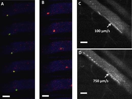 Figure 2. In vivo rolling of surface engineered MSCs. (A) In vivo confocal video images of sLex-MSCs with velocity 250 μm/s (green) were taken at 30 frames/s within the inflamed ear vessel (blue) after injection of MSCs. (B) In vivo confocal video images of unmodified MSCs with velocity 1100 μm/s (red) were taken at 30 frames/s within the inflamed ear vessel (blue) after injection of MSCs. (A-B) The vessel diameter is approximately 60 μm, and the critical velocity is 571 μm/s. (C) Representative image of sLex-MSCs interacting with inflamed endothelium in approximately 60 μm vessel resulting in velocity of 100 μm/s (103 frames stacked with 30 fps; ie, sLex-MSC remains in the field of view for > 3.3 seconds). (D) Representative image of unmodified MSCs interacting with inflamed endothelium in approximately 60 μm vessel resulting in velocity of 750 μm/s (27 frames stacked with 30 fps; ie, unmodified MSC remains in the field of view for < 0.9 seconds). Bar represents 50 μm.