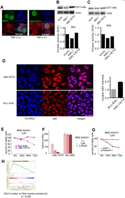 Figure 6. AML1/ETO-induced leukemic cells depend on NF-κB signaling. (A) Nuclear translocation assays of p65 in HEK293T cells transduced with AML1 (left) or AML1/ETO (right), 20 minutes after the addition of TNF-α. Scale bar represents 10 μm. (B-C) In vitro kinase assays of IKKα (B) or IKKβ (C) in HEK293T cells transduced with AML1 or AML1/ETO, 20 minutes after the addition of TNF-α. (D) Immunofluorescent staining of p65 in the BM cells transformed with AML1/ETO (top) or MLL/ENL (bottom). Scale bar represents 10 μm. Blue indicates TO-PRO3 (nucleus), and red indicates p65. The mean intensity of nuclear localized p65 was quantified with ImageJ Version 1.41o software.31 (E) Comparison of sensitivities between AML1/ETO-transformed cells with MLL/ENL-transformed cells in liquid culture. (F) Colony counts from the serial replating assay of AML1/ETO- or MLL/ENL-transformed cells with BMS-345541. Error bars show mean ± SEM (G) Comparison of sensitivities between Kasumi-1 cells (AML1/ETO) with THP-1 cells (MLL/AF9) in liquid culture. (H) Enrichment of NF-κB target genes in t(8;21) leukemia cluster (c13) compared with other clusters (except c5).28
