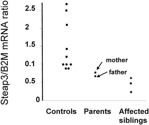 Figure 3. Quantitative RT-PCR of STEAP3/TSAP6 mRNA from blood cells. The results of STEAP3/TSAP6 mRNA quantification are expressed in arbitrary units as the ratio of STEAP3/TSAP6 mRNA to B2M mRNA (STEAP3/B2M). Quantitative PCR was carried out for each cDNA sample, and the ratios of STEAP3 to the control gene B2M were calculated as the mean of triplicate determinations. A wide range of variation for 10 normal control subjects was observed (3-fold) and both parents were in the lower range of the controls. Note that in the father and in his 3 affected children, only the normal allele was detected by sequencing of RT-PCR products because of degradation of the mutated allele (Figure 2B).