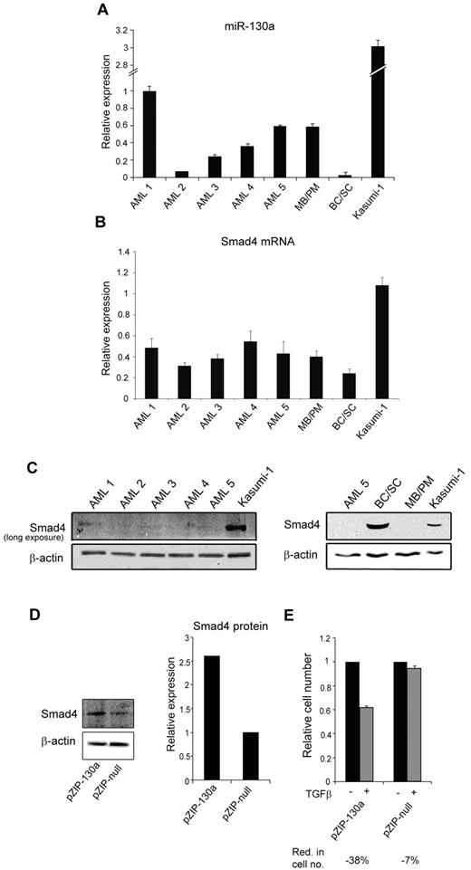 Figure 7. miR-130a expression in AML t(8;21) and Kasumi-1 cells. The relative miR-130a expression in BM samples from 5 patients with AML with the t(8;21) chromosomal translocation, MB/PM and BC/SC cells from a healthy donor, and in Kasumi-1 cells was measured by real-time PCR with RNU6 as normalizer. Data are shown as the mean ± SD from triplicate measurements. (B) Relative expression of Smad4 mRNA in the same samples as in panel A after normalization to β-actin expression. Data are shown as mean ± SD from triplicate measurements. (C) Immunoblot of Smad4 protein expression in the 5 AML samples (AML 1-5) and Kasumi-1 cells. The exposure time was extended to get a signal in the AML samples. Immunoblot of AML5, BC/SC, MB/PM, and Kasumi-1 cells. β-actin was used a loading control. (D) Kasumi-1 cells were transiently transfected with pmiRZIP-130a (pZIP-130a) or pmiRZIP-null (pZIP-null), and Smad4 protein expression was determined by immunoblotting. The graph displays the relative expression of Smad4 normalized to β-actin expression. (E) Cell proliferation assays performed on Kasumi-1 cells transiently transfected with pmiRZIP-130a (pZIP-130a) or pmiRZIP-null (pZIP-null) in the presence or absence of human recombinant TGF-β1 (20nM). The graph shows the relative number of cells after 4 days when TGF-β1–stimulated cells are compared with unstimulated cells for each transfection. The mean reduction in cell number (Red. in cell no.) for TGF-β1–stimulated cells for each transfection was 38% for pZIP-130a and 7% for pZIP-null.