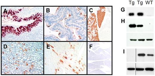 Figure 2. Expression of the human λ6 LC protein in CMV-λ6 transgenic mice. (A-F) Immunohistochemistry demonstrating human λ LC expression (red-brown staining) in (A) stomach, (B) bladder, (C) pancreas, (D) kidney, and (E) heart. (F) Pancreas stained with human κ LC antibody (negative control) is also shown. Antibodies used were Dako nos. A0193 (λ) and A0191 (κ). (G-I) Immunoblots of human λ LC expression (top panels) in serum (G), pancreas (H), and stomach (I) tissue extracts from transgenic (Tg) and wild-type (WT) littermate mice. β-actin was used as a loading control (H-I bottom panel). The anti–human λ antibody used was Sigma-Aldrich no. L5267. The vertical line indicates that noncontiguous lanes from the same immunoblot image are shown.