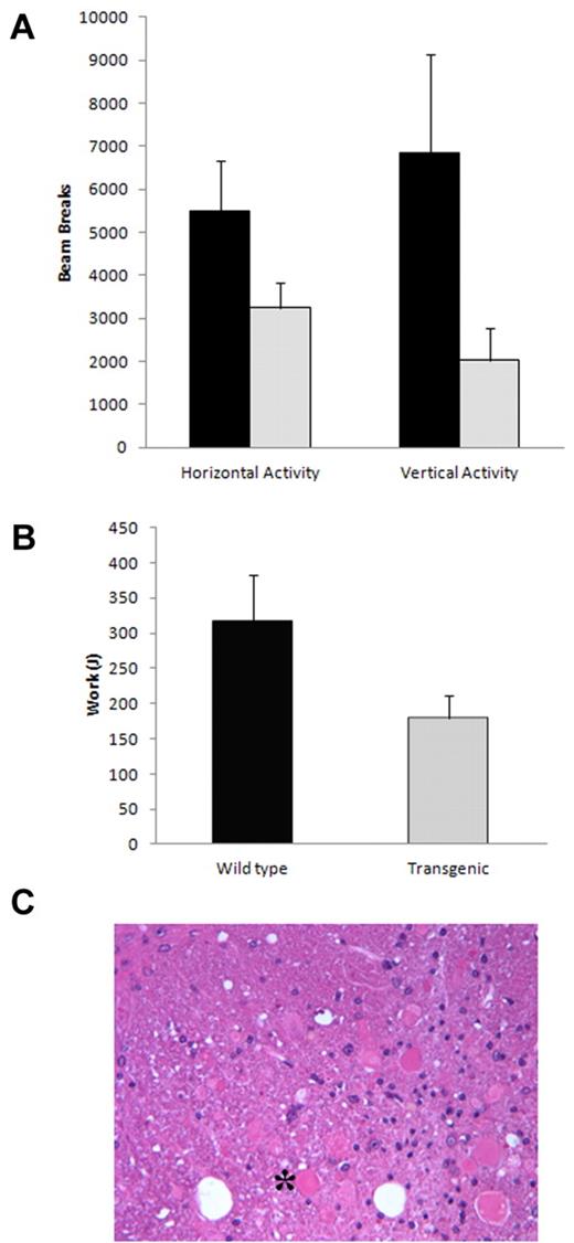 Figure 5. Neurologic phenotype in CMV-λ6 mice. (A) The transgenic mice displayed less spontaneous activity compared with wild-type controls when fasted overnight (P < .018 horizontal, P < .0068 vertical, n = 4 each group). (B) Exercise capacity on an inclined treadmill was diminished in older transgenic mice compared with age-matched controls (P < .011, n = 4 each group). (C) H&E-stained section of spinal cord revealing dystrophic neurons (example denoted as *) in an old transgenic mouse with the limb clenching phenotype.