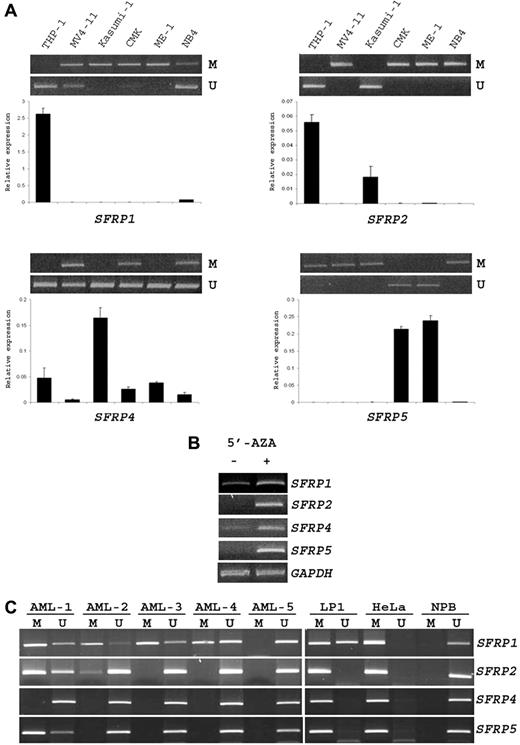 Figure 1. Methylation of SFRP promoters in AML cell lines and childhood patients with AML. (A) MSP (top) and real-time RT-PCR (bottom) analysis of SFRP promoter methylation and expression in 6 AML cell lines. M and U represent PCR products with primers specific for the methylated and unmethylated sequences, respectively. SFRP mRNA levels were normalized to GAPDH and compared with the mean expression levels of 3 normal BM samples. Results are presented as mean ± SE from triplicate assays. Note that SFRP promoter methylation was associated with mRNA down-regulation in these cell lines. (B) Semiquantitative RT-PCR analysis of SFRP expression in MV4-11 cells after treatment with the DNA demethylating agent 5′-AZA. Amplification of GAPDH cDNA served as internal control. (C) Representative MSP analysis of the 4 SFRP promoters in 5 childhood patients with AML (AML-1 to -5). The results of positive (LP1 and HeLa cell lines) and negative (NPB, normal peripheral blood) controls are also shown.