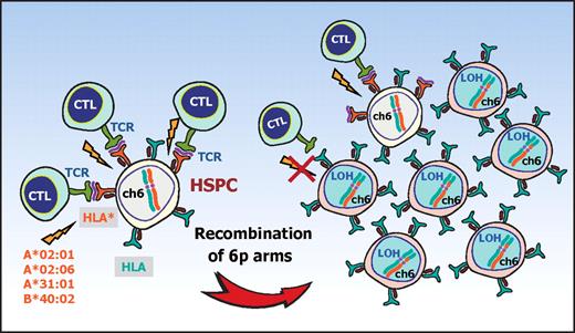 Figure 5. A proposed mechanism for escape hematopoiesis in 6pLOH(+) AA. In AA, the targets of CTLs are the HSPCs that present some auto-antigen through particular class I HLA molecules, including HLA-A*02:01, A*02:06, A*31:01, and B*40:02. In the presence of these autoimmune insults, the HSPCs that lose their expression of the antigen-presenting HLA molecule as a result of CNN-LOH in 6p would acquire a growth advantage over other HSPCs expressing the relevant HLA, leading to clonal outgrowth of the 6pLOH(+) progenies.