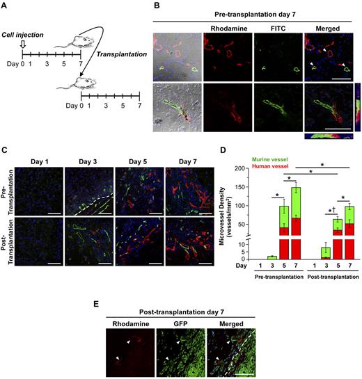 Figure 1. MVD analysis before and after transplantation. Matrigel implants were harvested at multiple time points before and after transplantation. (A) Diagram of transplantation model. (B-E) Perfused human and murine vessels were identified by tail-vein injection of a mixture of rhodamine (red)–conjugated UEA-I and FITC (green)–conjugated GS-IB4. (B) Representative confocal images of 3 distinct patterns of lectin-labeled vessels in the implants at pretransplantation day 7. White arrowheads indicate human, murine, and chimeric vessels. (C) Representative confocal images of lectin-labeled vessels in the implants at multiple time points. White dotted line in the day 3 panel of pretransplantation indicates the border of implant. (D) Graph of MVD before and after transplantation (n = 3-8; mean ± SEM). *Significant difference (P ≤ .05) between groups for total MVD. †Significant difference (P ≤ .05) between groups for human MVD. (E) Representative confocal images of GFP/UEA-I (rhodamine)–positive vessels in the implants at day 7 after transplantation into GFP-transgenic mice. White dotted line indicates the border of implant. Scale bars represent 100 μm.