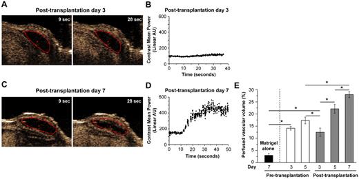 Figure 2. Perfused vascular volume before and after transplantation. ECFC/MPC/Matrigel suspensions were injected into a SCID mouse to form vascular networks in vivo, and the degree of perfusion in each implant was monitored at days 3 and 5 before transplantation, and days 3, 5, and 7 after transplantation. The 2D images were recorded as video (supplemental Videos 1 and 2) and analyzed. (A) Representative captured 2D image from low-perfused implant (posttransplantation day 3). (B) The plot of nonlinear ultrasound signal intensity (expressed in arbitrary units) integrated over the region of interest of the image plane of Figure 2A (contrast agent was injected at ∼ 10 seconds). (C) Representative captured 2D image from high-perfused implants (posttransplantation day 7). (D) Nonlinear ultrasound signal intensity as described in panel B, integrated over the region of interest of image plane of Figure 2C. (E) Perfused vascular volume was measured by collecting a stack of 2D images from the anterior to posterior ends of the implant (supplemental Videos 3 and 4). The difference in the percentage of voxels returning an ultrasound signal before and after contrast agent injection is perfused vascular volume (percentage), the proportion of implant volume occupied by functional, perfused vessels. *Significant difference (P ≤ .05) between groups (n = 8 for each time point; n = 5 for Matrigel control).