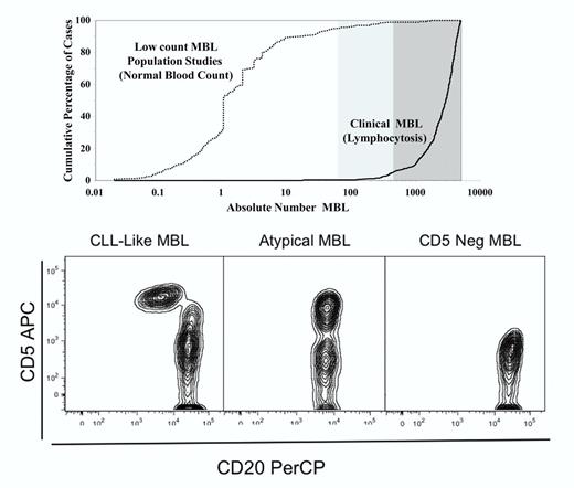 Role of absolute B-cell count in MBL and immunophenotype patterns. The top panel shows the absolute number of B cells as a cumulative function of the number of cases dividing low-count MBL (normal white blood cell count, absolute lymphocyte count) from clinical MBL (with lymphocytosis). The bottom panel from left to right shows the 3 major immunophenotypic patterns seen in MBL.