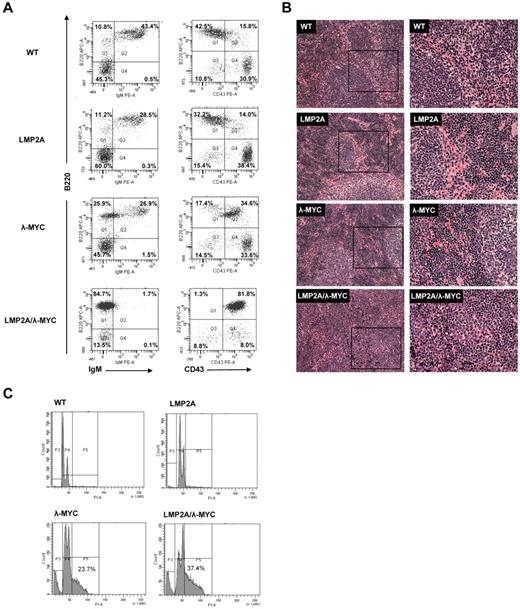 Figure 1. Pretumor transgenic mouse phenotypes. (A) Total splenocytes were harvested from 3-week-old littermates, stained with B220-APC (y-axis) and IgM-PE or CD43-PE (x-axis), and analyzed by flow cytometry. The percentage B220+, IgM−, or CD43− (Q1), B220+, IgM+, or CD43+ (Q2), B220−, IgM−, or CD43− (Q3), and B220−, IgM+, or CD43+ (Q4) is indicated for each genotype. Data are presented for individual mice but are representative of 7 to 14 mice analyzed per genotype (see also summarized data in Tables 1 and 2). (B) Spleens of the indicated genotype were fixed in 10% buffered formalin phosphate followed by paraffin embedding. Spleens were then sectioned and stained with H&E. The beginning of normal splenic structures can be observed (see arrows), with the LMP2A/λ-MYC spleen less organized. The rectangles in the left-hand column represent the area that is magnified in the right-hand column. (C) Spleens were isolated from 3-week-old littermates, and B cells were purified using a MACS protocol with magnetic beads specific for the B-cell marker CD19. Purified B cells were fixed with paraformaldehyde and ethanol and then stained with propidium iodide (x-axis) to measure the percentage of cycling cells. Cells were analyzed by flow cytometry to measure the percentage of cells that fall into the sub G0, G0/G1, or S/G2/M gates.