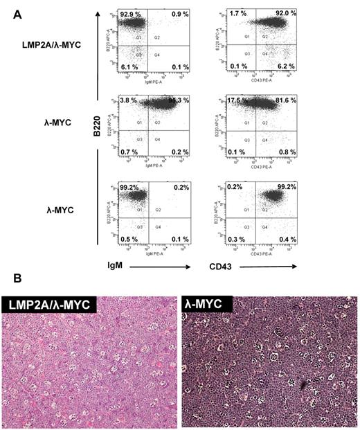 Figure 2. Phenotype of transgenic mouse tumors. (A) Cervical lymph node tumor cells were harvested from tumor-burdened mice and stained with B220-APC (y-axis) and IgM-PE or CD43-PE (x-axis) and analyzed by flow cytometry. The percentage of cells that fall within each quadrant is indicated. Both IgM+ (n = 7) and IgM− (n = 5) λ-MYC tumors are observed, and an example of each is shown. All LMP2A/λ-MYC tumors are IgM− (n = 18; see also summarized quadrant data in Tables 3 and 4). (B) Cervical lymph node tumors were isolated from tumor-burdened mice and fixed in 10% buffered formalin phosphate followed by paraffin embedding. Tumors were then sectioned and stained with hematoxylin and eosin. Note the “starry sky” pattern that is also characteristic of human Burkitt lymphoma tumors.