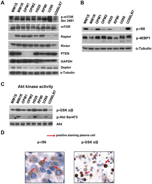 Figure 1. MM cells are characterized by constitutive activation of the PI3K/Akt/mTOR pathway. (A) Immunoblotting for p-mTOR at Ser2481, mTOR, Raptor, Rictor, Deptor, PTEN. and α-tubulin in MM cell lines. (B) Immunoblotting for p-rS6 Ser235/236, p-4EBP1 Thr37/46, and α-tubulin in MM cell lines. (C) In vitro Akt kinase assay and immunoblotting for p-Akt Ser473 and total Akt. For the Akt kinase assay, whole-cell lysates were immunoprecipitated with anti-Akt Ab, and then the immunoprecipitate was washed and subjected to the in vitro kinase assay according to the manufacturer's protocol. Western blot analysis was performed with anti–p-GSK3α/β. (D) BM biopsies from MM patients (n = 25) were fixed in Zanker formalin, embedded in paraffin blocks, and sectioned. Sections were then stained for p-rS6 Ser235/236 and p-GSK3α/β.