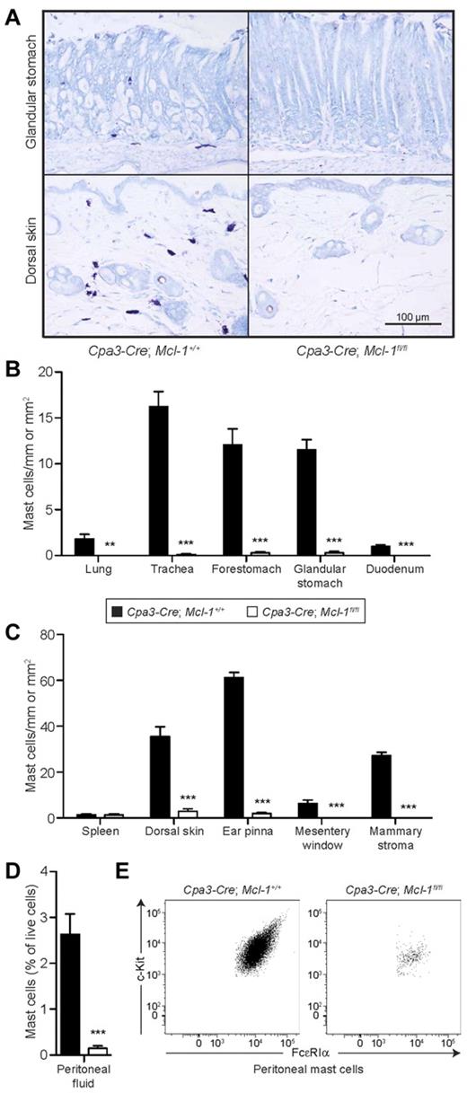 Figure 3. Cpa3-Cre; Mcl-1fl/fl mice have markedly reduced numbers of mast cells. (A) Toluidine blue staining for mast cells in 4-μm-thick paraffin sections of glandular stomach wall (top) and dorsal skin (bottom) in Cpa3-Cre; Mcl-1+/+ mice (left) and Cpa3-Cre; Mcl-1fl/fl mice (right) shows a marked reduction in numbers of mast cells (purple) in mice in which Mcl-1 has been selectively deleted by Cpa3-Cre. Scale bar indicates 100 μm. (B-C) Numbers of mast cells in various tissues in Cpa3-Cre; Mcl-1+/+ (control) mice or Cpa3-Cre; Mcl-1fl/fl mice. Numbers of mast cells are shown as means + SEM per millimeter or per square millimeter of 4-μm-thick paraffin sections stained with 0.1% Toluidine blue (see “Methods”) in tissues from Cpa3-Cre; Mcl-1+/+ (n = 16) or Cpa3-Cre; Mcl-1fl/fl (n = 14) mice, except for mesentery window (n = 12 per group) and mammary stroma (n = 6 per group). (D) Percentage of mast cells in the live-cell population isolated from peritoneal lavage fluid from Cpa3-Cre; Mcl-1+/+ (control, n = 10) or Cpa3-Cre; Mcl-1fl/fl (n = 10) mice, analyzed by flow cytometry (FcϵRIα+; c-Kit+). Peritoneal mast cell numbers are shown as means + SEM. (B-D) **P < .01 and ***P < .001 versus corresponding values for Cpa3-Cre; Mcl-1+/+ mice. (E) Representative flow cytometry plots show comparable expression of FcϵRIα+ on peritoneal mast cells isolated from Cpa3-Cre; Mcl-1+/+ or Cpa3-Cre; Mcl-1fl/fl mice. In panels B-D, mice ranged from 3-10 months of age; mouse age did not influence mast cell numbers in each genotype (data not shown). Images were captured with an Olympus BX60 microscope with a 20× objective using a Retiga-2000R QImaging camera run by Image-Pro Plus Version 6.3 software (Media Cybernetics) and exported into Adobe Photoshop (CS3), in which images were white balanced and resized.