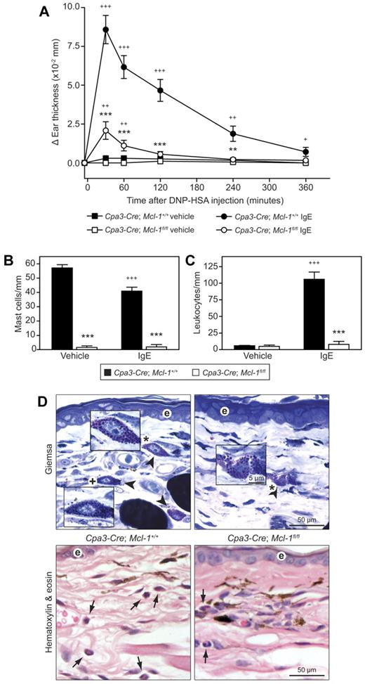 Figure 5. Cpa3-Cre; Mcl-1fl/fl mice exhibit markedly reduced mast cell–dependent tissue swelling and leukocyte recruitment in IgE-dependent PCA. The data shown in panels A through C were pooled from the 3 independent experiments performed, each of which gave similar results. (A) Cpa3-Cre; Mcl-1fl/fl mice (n = 9) and Cpa3-Cre; Mcl-1+/+ control mice (n = 12) were sensitized by intradermal injection of 20 ng of anti-DNP IgE into the right ear pinna, with vehicle injection into the left ear pinna as a control. Mice were challenged by retro-orbital injection of 100 μg of DNP-HSA the next day. Ear swelling was measured at the indicated time points and data are shown as means ± SEM. **P < .01 and ***P < .001 versus corresponding values for Cpa3-Cre; Mcl-1+/+ mice at the indicated time points. +P < .05, ++P < .01, and +++P < .001 versus corresponding values for contralateral vehicle control ears in mice of the same genotype at the indicated time points. P < .0001 by 2-way ANOVA for the swelling response in ears sensitized with anti-DNP IgE in Cpa3-Cre; Mcl-1fl/fl versus Cpa3-Cre; Mcl-1+/+mice. (B-C) Numbers of mast cells (B) and leukocytes (C) in the dermis of ear pinnae of Cpa3-Cre; Mcl-1fl/fl mice (n = 9) and Cpa3-Cre; Mcl-1+/+ control mice (n = 12) 6 hours after induction of PCA (IgE) or after in vehicle-treated control ears (vehicle). Data are shown as means + SEM for mast cells or leukocytes per millimeter of dermis. ***P < .001 versus corresponding values for Cpa3-Cre; Mcl-1+/+ mice; +++P < .001 versus corresponding values for vehicle-treated mice in mice of the same genotype. (D) Giemsa staining to demonstrate mast cells (top, in 1-μm-thick, Epon-embedded sections) and H&E staining to demonstrate leukocytes (bottom, in 4-μm-thick, paraffin-embedded sections) in ear pinnae 6 hours after induction of PCA reactions. There are decreased numbers of mast cells (solid arrowheads in upper panels) and leukocytes (some indicated by solid arrows in lower panels) in sections from Cpa3-Cre; Mcl-1fl/fl mice (right panels) versus Cpa3-Cre; Mcl-1+/+ mice (left panels) subjected to PCA. Top: Some mast cells (*) exhibit alterations of the staining or location of many cytoplasmic granules, changes that are indicative of degranulation, whereas other mast cells (+) exhibit few or no granules exhibiting such changes. Bottom: Black arrows indicate leukocytes (primarily neutrophils). Insets depict selected mast cells exhibiting morphological evidence of extensive (*) or minimal or no (+) degranulation. Scale bars indicate 50 μm (for insets, scale bars indicate 5 μm); e indicates epidermis. Images were captured with an Olympus BX60 microscope with a 20× objective using a Retiga-2000R QImaging camera run by Image-Pro Plus Version 6.3 software (Media Cybernetics) and exported into Adobe Photoshop (CS3), in which images were white balanced and resized.