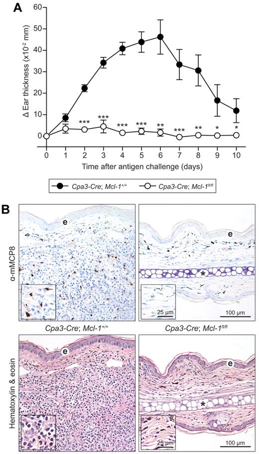 Figure 6. Cpa3-Cre; Mcl-1fl/fl mice have markedly reduced basophil-dependent tissue swelling and leukocyte recruitment in IgE-dependent CAI. (A) Cpa3-Cre; Mcl-1fl/fl mice (n = 10), and Cpa3-Cre; Mcl-1+/+ control mice (n = 14) were sensitized passively by IV injection of 300 μg of IgE anti-TNP. Mice were challenged the next day by intradermal injection of 10 μg of TNP-OVA into the left ear pinna and OVA (as a control) into the right ear pinna. Ear swelling was measured daily and the results are shown as means ± SEM. The data shown were pooled from the 3 independent experiments performed, each of which gave similar results. *P < .05; **P < .01; and ***P < .001 comparing swelling in ears of IgE-treated Cpa3-Cre; Mcl-1fl/fl mice versus corresponding values for Cpa3-Cre; Mcl-1+/+mice at the indicated time points. P < .0001 by 2-way ANOVA comparing the ear swelling responses in IgE-injected Cpa3-Cre; Mcl-1fl/fl versus Cpa3-Cre; Mcl-1+/+ mice. (B) Immunohistochemical visualization of basophils by staining with an anti-mMCP8 Ab (DAB substrate) and Giemsa counterstaining (top panel, in 4-μm-thick, paraffin-embedded sections) and H&E staining to demonstrate leukocytes (bottom panel, in 4-μm-thick, paraffin-embedded sections) in ear pinnae 3 days after induction of CAI reactions. There are markedly decreased numbers of basophils (brown) and leukocytes in sections from Cpa3-Cre; Mcl-1fl/fl mice (right) versus Cpa3-Cre; Mcl-1+/+ control mice (left) subjected to CAI. Scale bars indicate 100 μm (for insets, scale bars indicate 25 μm); *, ear cartilage; e, epidermis. Images were captured with an Olympus BX60 microscope with a 20× objective using a Retiga-2000R QImaging camera run by Image-Pro Plus Version 6.3 software (Media Cybernetics) and exported into Adobe Photoshop (CS3), in which images were white balanced and resized.