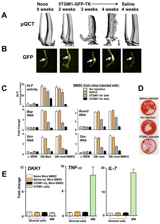 Figure 1. Development of lytic lesions in mice injected with 5TGM1-GFP-TK MM cells results in persistent OB suppression after culturing BMSCs in vitro. Mice were injected intratibially with 20 μL saline with or without 105 5TGM1-GFP-TK (5TGM1) cells and compared with uninjected controls. Lytic lesions were allowed to develop for the indicated time periods. At the end of each time point, the tibias were dissected, and micro-QCT and fluorescent images were obtained. (A) Micro-QCT images of right tibiae obtained from mice sacrificed at 0, 2, 3, and 4 weeks after their injection with 5TGM1-GFP-TK cells or at 4 weeks after saline injection. (B) Fluorescent images of the injected tibias taken using the LT-9MACIMSYSPLUS Fluorescence Imaging System. (C-D) BMSCs were recovered from these tibiae, treated with ganciclovir until no GFP+ MM cells were visible (10 days) and expanded (3 weeks), before starting OB differentiation by culturing with or without BMP2 (50 ng/mL) in either α-MEM or OB differentiation medium (OB med). (C) At day 5, protein lysates and RNAs were isolated for measurement of ALP activity and quantitative PCR analysis of Bsp, Ocn, Runx2, and Osx expression relative to the uninjected mice BMSCs (using 2−ΔΔCt analysis). GAPDH, reference gene. (D) At day 21, mineralization was assayed by alizarin red. (E) 5TGM1-GFP-TK cells and BMSCs (with the MM cells removed as in panel C and was photographed using a light box with no magnification) isolated from 4-week injected mice and controls were analyzed by quantitative PCR for expression of TNF-α, IL-7, and DKK1 and the data graphed relative to the BMSCs from uninjected mice using 2−ΔΔCt. GAPDH, reference gene. In 5TGM1-GFP-TK cells, relative to GAPDH using ΔCt analysis, relative fold mRNA expression was: TNF-α (48 ± 7), IL-7 (35 ± 12), and DKK1 (1 ± 0.3).