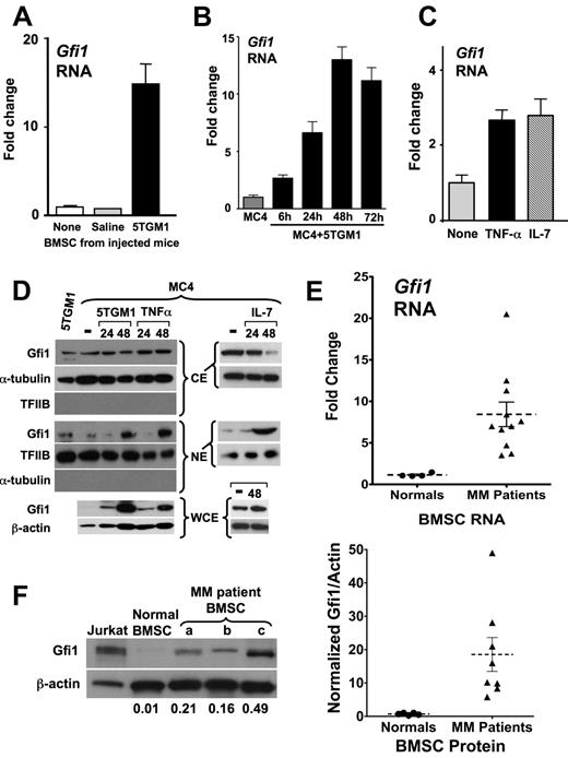 Figure 4. Gfi1, a transcriptional repressor, is induced in BMSCs and MC-4 cells by MM cells and TNF-α. (A) Primary BMSCs samples, as described in Figure 1, were analyzed for Gfi1 mRNA levels relative to GAPDH by quantitative PCR. (B) RNA from MC-4 cells cocultured with 5TGM1 cells (in transwell inserts) for the indicated times (h) before removal of the 5TGM1 cells and RNA isolation from the MC-4 cells. Expression of Gfi1 was detected by quantitative PCR relative to GAPDH and the “MC-4 alone” sample. (C) MC-4 cells were treated with 1 ng/mL TNF-α or IL-7 for 6 hours, and Gfi1 mRNA expression was determined by quantitative PCR relative to GAPDH. (D) Western blot analysis of Gfi1 protein expression and localization using whole cell, cytoplasmic, and nuclear extracts from 5TGM1 cells, MC-4 cells, and MC-4 cells treated with 5TGM1 cells in a transwell, TNF-α (1 ng/mL), or IL-7 (2 ng/mL). For loading controls, the blots were probed with anti–α-tubulin, TFIIB, or β-actin as indicated. Note that anti–TFIIB did not detect anything in the cytoplasmic extracts and anti–α-tubulin did not detect anything in the nuclear extracts, indicating that there was no significant cross-contamination of the subcellular compartments during their preparation. (E) The BM aspirates from MM patients and normals were cultured overnight; then the adherent cells were CD138-depleted using negative immunoselection (MACS, Miltenyi) and the BMSCs expanded for 3 weeks before use. Stromal cells obtained from 4 normals (●) and 11 MM patients (▴) were analyzed for Gfi1 expression by quantitative PCR relative to GAPDH and the fold change plotted with the SEM. Gfi1 RNA expression was significantly increased with a mean of 8.4-fold in the BMSCs from MM patients compared with the stromal cells from normals (P < .0006) using a 2-tailed unpaired t test with Welch correction. The Gfi1/GAPDH range for the normals was 0.24 to 1.23 and for the MM patients was 0.84 to 8.04 with the fold change MM relative to normal calculated among samples run at the same time. The 11 patients all had bone disease and stage 3 MM; 6 were newly diagnosed and 5 were relapsed, and there was no difference in the Gfi1 levels between these groups. (F) Western blot analysis for human Gfi1 protein expression in the BMSCs from 3 MM patients and 1 normal, along with Jurkat extract as a positive control (20 μg each). The ratio of Gfi1 to β-actin was calculated for each sample and noted below the blot. The ratio of Gfi1 to β-actin for these samples plus data from another 5 MM patients and 4 normals are plotted with the mean and SEM indicated. Gfi1 protein expression was significantly increased with a mean of 18-fold in the BMSCs from MM patients compared with the stromal cells from normals (P < .0194) using a 2-tailed unpaired t test.