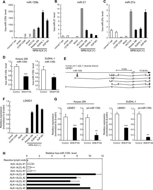 Figure 1. High expression of miR-135b and LEMD1 in ALCL. (A-C) Expression of mature miR-135b (A), miR-21 (B), and miR-27a (C) in NPM-ALK (+) ALCL cell lines (Karpas 299, SUDHL-1, and SUP-M2), normal T lymphocytes, and several T-lymphoblastic leukemia cell lines (Jurkat, CCRF-CEM, and Molt4), detected by qRT-PCR analysis. HCT116 colon cancer cells expressing endogenous miR-135b were used as positive control. ND indicates not detected. (D) Attenuation of miR-135b expression by ALK inhibitor WHI-P154. Mature miR-135b in Karpas 299 and SUDHL-1 cells was analyzed by qRT-PCR after WHI-P154 treatment (10μM, 4 hours). (E) Schematic diagram of genomic organization of human LEMD1 gene and miR-135b. As for human LEMD1, several splicing variants have been reported. miR-135b is located in the first intron of LEMD1 longer transcripts. (F) High expression of LEMD1 in ALCL cells, determined as in panel A. (G) Suppression of LEMD1 and pri-miR-135b by WHI-P154 (10μM, 1 hour) in Karpas 299 and SUDHL-1 cells, assessed as in panel D (*P < .05; **P < .01; ***P < .001). (H) Expression of miR-135b in clinical samples of ALCL patients.