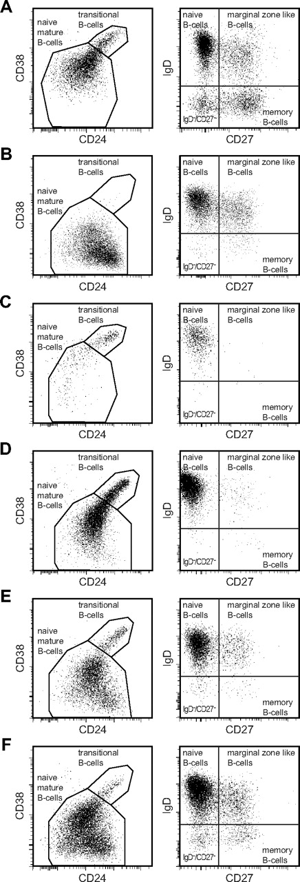Figure 1. Flow cytometric analysis of blood B-cell subsets in healthy controls and CVID patients. All B-cell subsets are determined within the CD19+ lymphogate. Naive B-cell subsets (transitional B cells and naive mature B cells) are defined within the CD27−IgD+ lymphogate based on expression of CD24 and CD38. (A) Healthy controls. (B-F) B-cell patterns observed in CVID patients. (B) B-cell pattern 1: low transitional and memory B cells. (C) B-cell pattern 2: low naive mature, marginal zone–like, and memory B cells. (D) B-cell pattern 3: low marginal zone–like and memory B cells. (E) B-cell pattern 4: low memory B cells. (F) B-cell pattern 5: normal marginal zone–like and memory B cells. Naive mature B cells cells in CVID patients (B-F) were more often CD38low compared with controls (A) and represent, at least in part, the CD21lowCD38low B-cell population within the naive B-cell compartment.