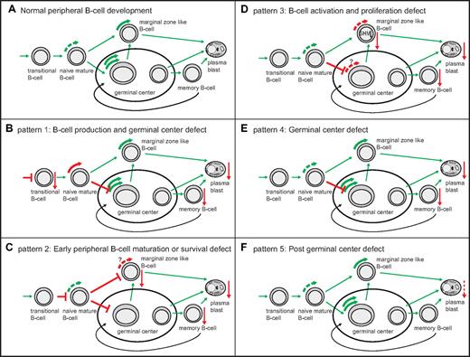 Figure 7. Model of the pathophysiological background of 5 B-cell patterns in CVID patients based on proliferation history and SHM levels. (A) Healthy peripheral B-cell development. Green curved arrows depict healthy B-cell proliferation. (B-F) abnormal peripheral B-cell development in the 5 B-cell patterns. Top left side: proposed pathophysiology and corresponding B-cell pattern. Red straight arrows depict decreased subset size (arrow pointing downward). T-shaped red bars depict a proposed block in B-cell development. (B) Red curved arrow depicts increased proliferation of naive B cells. (C) Red interrupted curved arrows depict decreased proliferation of marginal zone–like B cells.