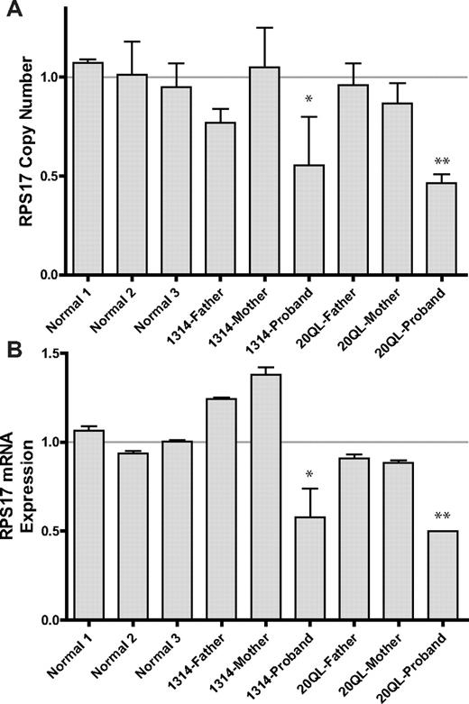 Figure 3. RPS17 copy number and expression by Q-RT-PCR. (A) Copy number at RPS17 was measured after internal normalization to an intergenic region of the β-hemoglobin locus in 3 normal control individuals, the 1314 and 20QL probands, and their parents. Normal copy number (ie, 4N) was defined as the average of 3 normal control individuals in each experiment. Both DBA probands showed reduced copy number at RPS17. (B) RPS17 expression levels were measured by internal normalization to RPL35A. Both deletion probands manifest haploinsufficiency of RPS17 mRNA, with levels consistent with approximately 50% expression. Graphs depict the average of 3 independent experiments, with each control and reference gene assayed in triplicate at each experiment. Normal expression (1.0) was taken as the average of 3 normal individuals in each experiment. Error bars depict the SEM. *P < .001 and **P < .0001 by unpaired t test compared with averaged normal controls.