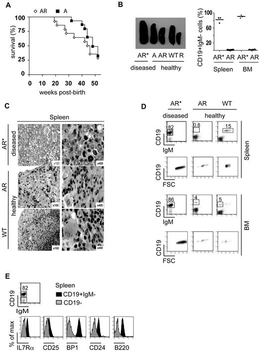 Figure 1. Phenotype of pro-B-cell leukemia in AR mice. AR and A mice were kept in a pathogen-free animal facility and were euthanized at the first signs of illness. (A) Kaplan-Meier analysis of overall survival as a percentage of AR mice (◊, n = 19) and A mice (■, n = 17) without any treatment over a 52-week follow-up period postbirth. A log-rank test was used to compare survival in the 2 cohorts (P < .3887). (B) Macroscopic splenomegaly in diseased AR* mice, compared with spleens of healthy, age-matched A, AR, WT, and R mice, as well as a CD19+IgM− cell population as the percentage of total MNCs in the spleen and BM of diseased AR mice (AR*) and age-matched healthy AR mice. (C) Hematein-eosin staining of spleen sections from an AR* mouse, an age-matched healthy AR mouse, and a WT mouse at 100× and 400× magnification. Lymphoblast infiltration (*) and atypical mitoses (**) are present in the AR* spleen sections. Normal, extramedullar hematopoiesis showing erythroblasts and megakaryocytes is present in the healthy AR and WT mice. (D) FACS analysis of BM and spleen from a diseased AR* mouse and healthy, age-matched AR and WT mice gated on the white blood cell (WBC) populations after RBC lysis. Dot plots indicate the percentage of the immature lymphoblastoid CD19+IgM− (AR*), healthy immature CD19+IgM− (AR), and mature CD19+IgM+ (WT) B-cell compartments in the spleen and the immature (CD19+IgM−) populations in the BM of the indicated mice, respectively. (E) Histograms indicate the surface expression (according to an immunofluorescence analysis) of IL7Rα, CD25, BP1, CD24, and B220 gated on the CD19+IgM− population of an AR pro-B-cell leukemia sample from the spleen.