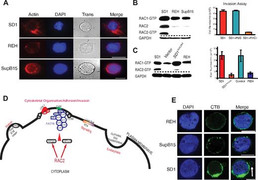 Figure 3. RAC2 is associated with cytoskeletal reorganization and invasion by SD1 cells. (A) Organized filamentous actin is present in SD1 cells compared with REH and SupB15. Cells were stained with Alexa Fluor 555 phalloidin (red); DAPI stains the nuclei. Trans refers to bright-field images. Original magnification is ×100. Scale bar indicates 5 μm. (B) Whereas all cell lines expressed RAC1, SD1 alone expressed detectable active RAC2 (left panel). Invasion by SD1 cells was significantly (P < .0001) inhibited by preincubation with a RAC inhibitor (RACi, 100μM; right panel). (C) SD1RAC2kd cells expressed RAC1 but not RAC2 (left panel) and exhibited significantly decreased in vitro invasion compared with SD1 (P = .009; right panel). Dashed lines denote spliced noncontiguous lines within gels. (D) Conceptual model of proteins identified in Table 1 suggesting that adhesion is mediated by ICAM1 and LFA-1 as part of a RAC2-initiated invasion process. (E) All 3 cell line membranes were enriched in lipid rafts, most prominently in SD1. In addition, in SD1, lipid raft–enriched peripheral vesicles are seen (arrow). Lipid rafts were labeled with the fluorophore-tagged cholera toxin B subunit (green); DAPI stains the nucleus. Original magnification is ×100. Scale bar indicates 10μm. For panels A and E, data were viewed and captured using a low light imaging system based around a Zeiss Axiovert 200M microscope using a Zeiss α Plan-Fluor 100×/1.45 numerical aperture (NA) objective lens and an Andor iXon3 EMCCD 888 camera. Using Applied Scientific Imaging MS2000, stage focus and volume imaging were attained. The system illumination was controlled via Sutter λ 10-3 and associated filter wheels and light sources were a Sutter Lambda-LS 300W Xenon UV light source and a Thorlabs white light LED for transmitted light. UV filters used were the Chroma ET-Sedat filter set. The equipment was enclosed in an environmental chamber and for fixed cell imaging, all work was carried out at 25°C. The equipment was controlled via Metamorph software (Molecular Devices).