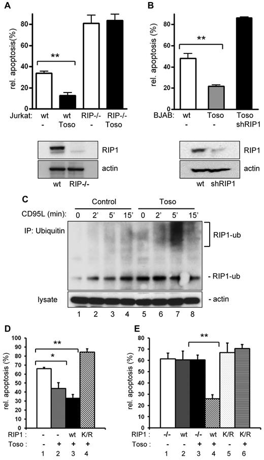 Figure 2. RIP1 is required for the antiapoptotic function of Toso and Toso facilitates RIP1 ubiquitination in response to CD95 stimulation. (A) Wild-type or RIP1 deficient Jurkat cells were transfected with a control or a Toso construct. Cells were stimulated with CD95L for 5 hours and apoptosis was assessed by annexin V staining. RIP1 (top) and actin (bottom) expression levels in cell lysates are shown by Western blotting. Data are representative of 3 experiments. Statistical analysis: Student t test (*P < .05, **P < .01). (B) BJAB cells stably expressing Toso were transfected with 3 different RIP1 specific shRNA constructs or mock treated. CD95-induced apoptosis was analyzed as in panel A. The knock-down efficiency of RIP1 was monitored by immunoblotting for RIP1 (top). Actin was used as a control for protein loading (bottom). Data are representative of 2 experiments. (C) Jurkat cells were transiently transfected with a control or a Toso construct. Cells were stimulated with CD95L for the indicated times and ubiquitinated proteins were isolated by immunoprecipitation (IP) using an antiubiquitin antibody. Ubiquitinated endogenous RIP1 was detected in immunoprescipitates using RIP1 antibody (top) and total lysates were probed for actin (bottom). Data are representative of 2 experiments. (D) The antiapoptotic function of Toso depends on RIP1 ubiquitination at lysine 377. Wild-type Jurkat cells were transiently transfected with control pIRES-GFP vector (lane 1), Toso-IRES-GFP only (lane 2), wt RIP1-FLAG and Toso-IRES-GFP (lane 3), or RIP1-K377R-FLAG (K/R) and Toso-IRES-GFP (lane 4). Cells were stimulated with CD95L for 5 hours. Apoptotic cells in the GFP+ population were determined by annexin V staining. Representative data from 5 independent experiments are shown. Statistical analysis: Student t test (*P < .05, **P < .01). (E) RIP1 deficient Jurkat (RIP1−/−) cells were transiently transfected with control pIRES-GFP vector (lane 1), wt RIP1-FLAG and control pIRES-GFP vector (lane 2), Toso-IRES-GFP only (lane 3), wt RIP1-FLAG and Toso-IRES-GFP (lane 4), RIP1-K377R-FLAG (K/R) and control pIRES-GFP vector (lane 5), or RIP1-K377R-FLAG (K/R) and Toso-IRES-GFP (lane 6). Cells were stimulated with CD95L for 5 hours. Apoptotic cells in the GFP+ population were determined by annexin V staining. Representative data from 3 independent experiments are shown.