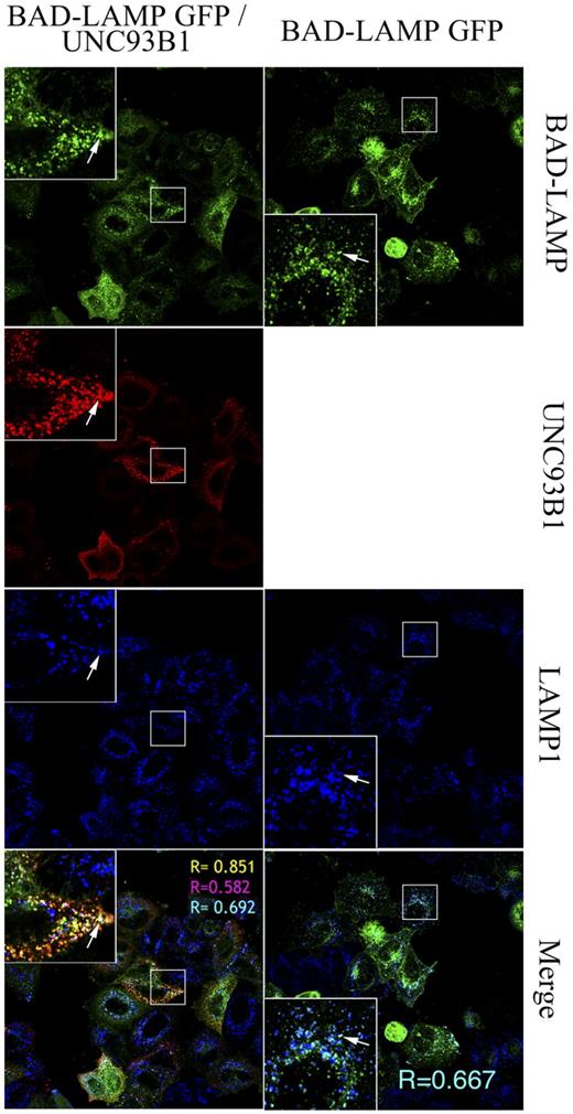 Figure 7. BAD-LAMP–dependent sorting of UNC93B1 to the endosomes. Immunofluorescence confocal microscopy of HeLa cells transfected with an eGFP-tagged BAD-LAMP fusion. BAD-LAMP-GFP (green) is sorted to intracellular compartments that are mostly LAMP1+ (blue, arrow, top panels). In cells cotransfected with BAD-LAMP-GFP and UNC93B1 (red, bottom panels), the 2 molecules are sorted together in LAMP1+ intracellular compartments. Pearson coefficient values are shown as R.