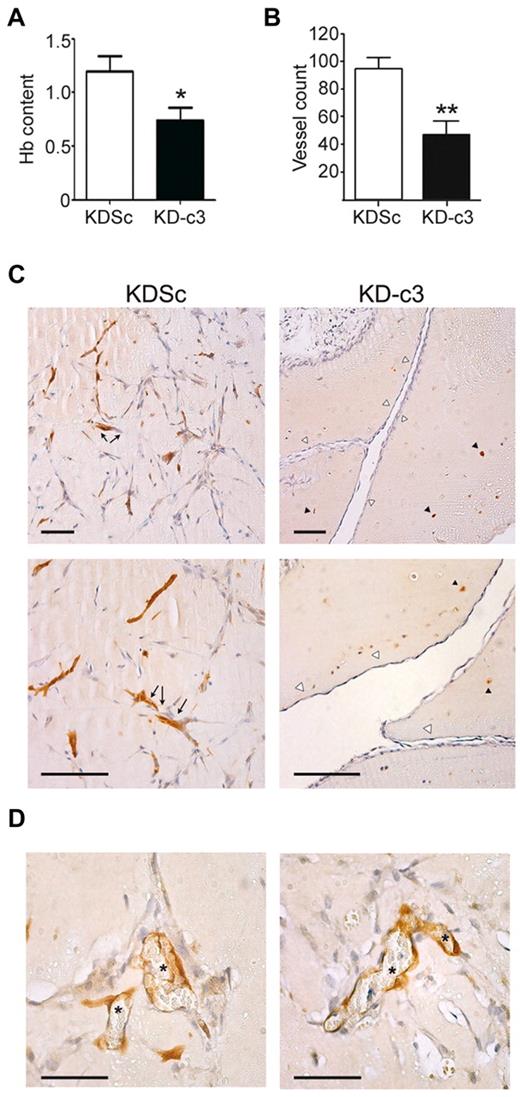 Figure 6. NFATc3 knock-down blocks COX-2-dependent in vivo angiogenesis. Matrigel plugs embedded with VEGF (500 ng/mL) and KDSc and KD-c3 human endothelial cells (2.5 × 105/mouse) were implanted in nude mice and 10 days later were collected and analyzed. (A) Hemoglobin was measured spectrophotometrically at 605 nm. Graph shows means ± SD from 3 independent experiments. (B) Matrigel plugs containing KDSc or KD-c3 HUVECs were paraffin embedded and sectioned. Vessel count is the number of vessels counted in H&E-stained sections (means ± SD; n = 3). (C) Paraffin sections of Matrigel plugs containing either KDSc or KD-c3 HUVECs were stained with anti-GFP antibody. Left panels are micrographs showing vessel-like structures formed by KDSc-expressing HUVECs (arrows). Right panels are KD-c3-expressing HUVECs unable to form vascular structures (black arrowheads); instead, vessels present in these plugs were mainly composed of GFP− host cells (white arrowheads). Bars indicate 100μm. (D) Micrographs showing vessels formed by GFP+ endothelium (left) with an evident lumen containing blood cells (asterisks). Bars indicate 50μm. *P < .05 and **P < .01 compared with control (KDSc).